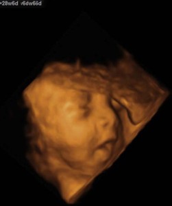 35 week 3d ultrasound